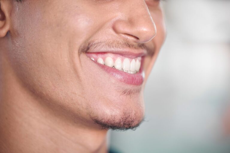 „Veneers oder Bleaching – Welche Methode ist die richtige für ein strahlendes Lächeln?“